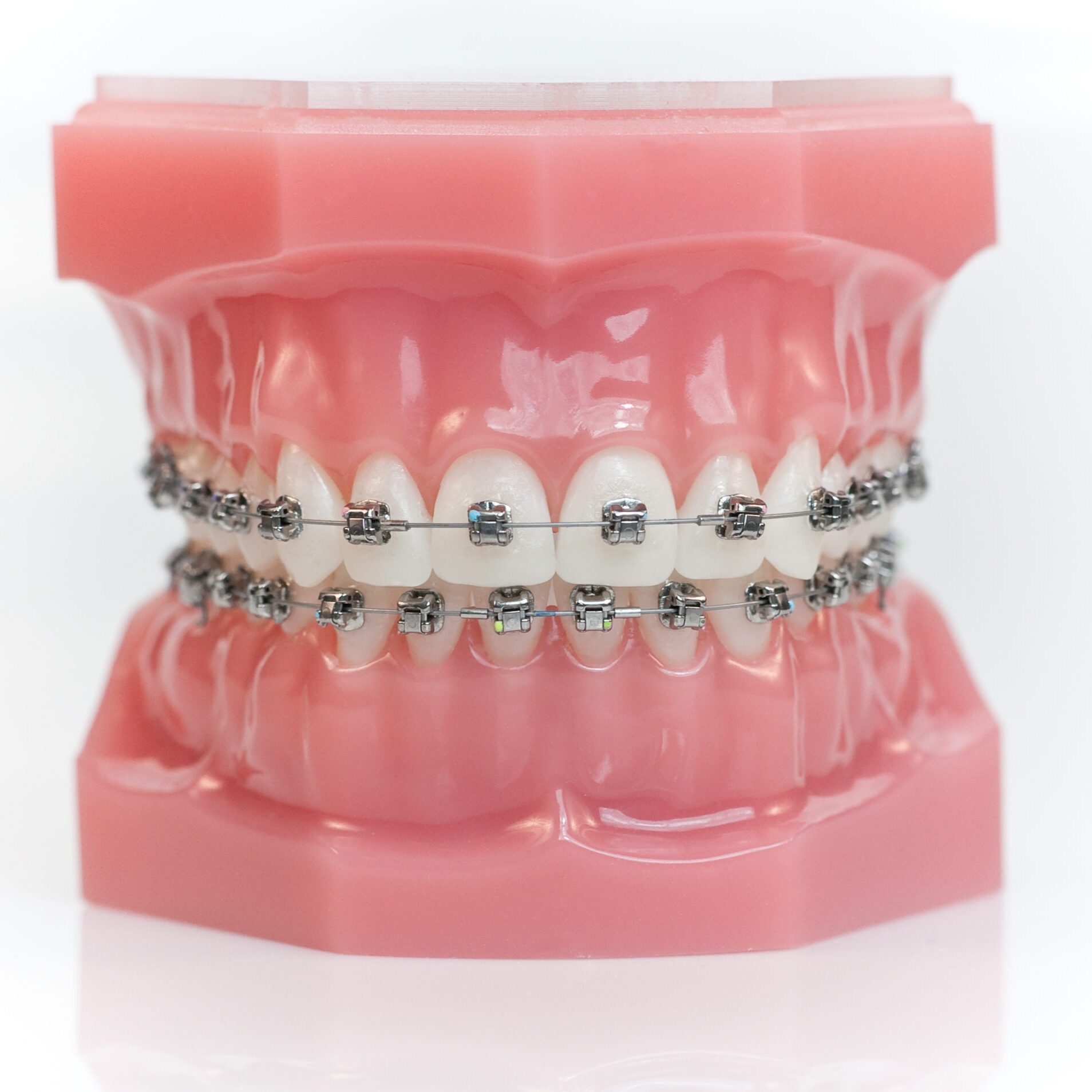 mooresville braces